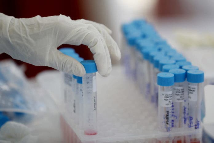 Cuatro fallecidos por Covid en las últimas 24 horas en República Dominicana